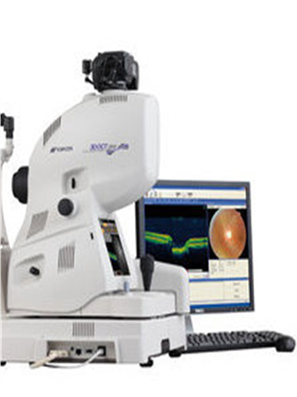 Optical Coherence Tomography machine for CHF